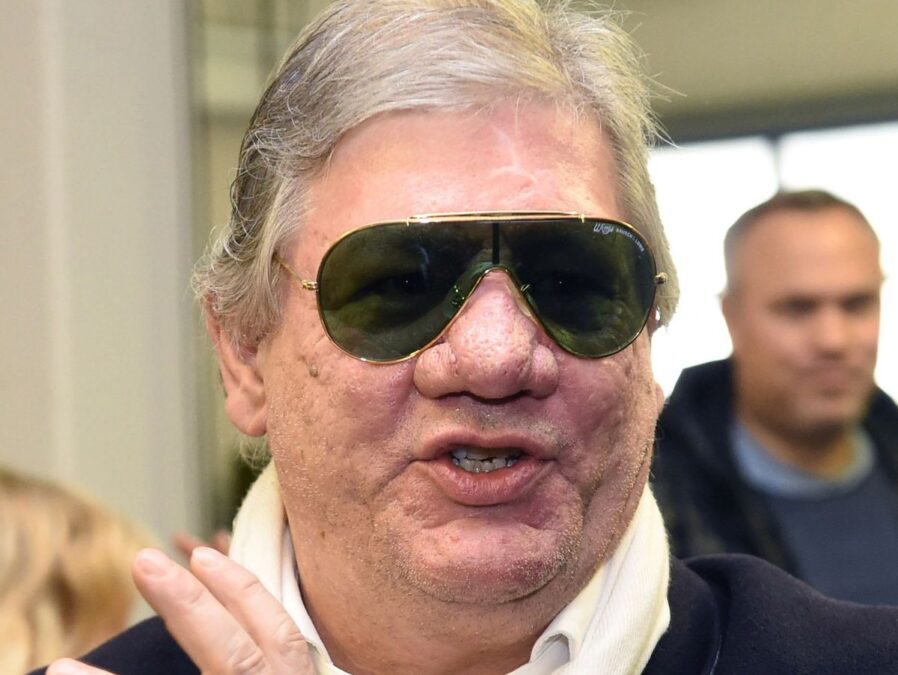 Alles über Claude-Oliver Rudolphs Nase Krankheit: Hintergründe, Fakten & Gesundheit Alles über Claude-Oliver Rudolphs Nase Krankheit